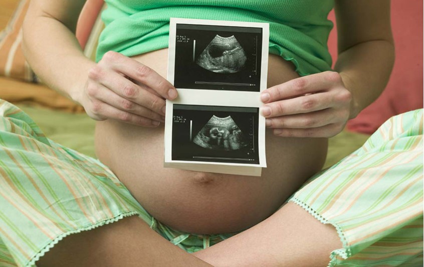 Ποια είναι η κατάλληλη διάρκεια μίας εγκυμοσύνης;