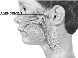 Αδενοειδείς εκβλαστήσεις – Κρεατάκια